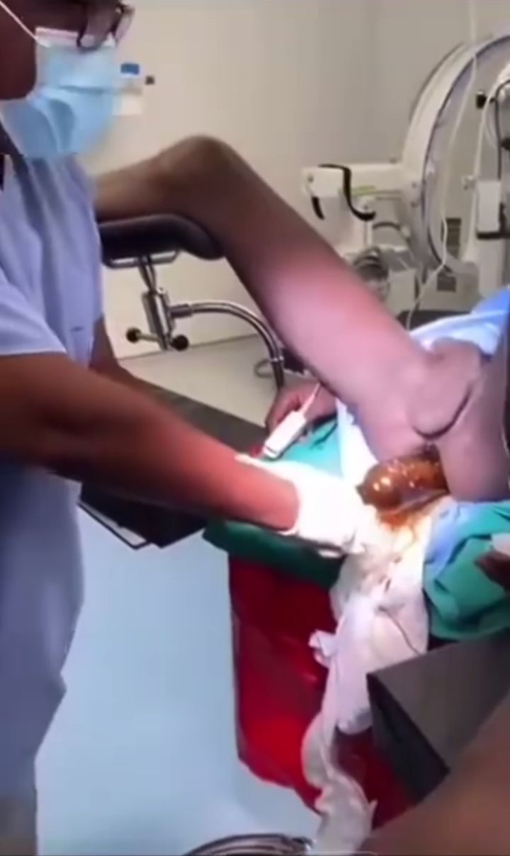 [TrendyMediaToday.com] Doctors Remove Bottle Of Cocaine From Nigerian Igbo Man’s Anus In England (18+) {file_size} {filename}